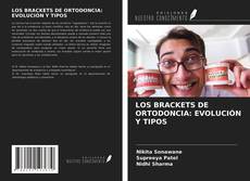 Bookcover of LOS BRACKETS DE ORTODONCIA: EVOLUCIÓN Y TIPOS