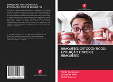 Buchcover von BRAQUETES ORTODÔNTICOS: EVOLUÇÃO E TIPO DE BRAQUETES