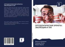 Bookcover of ОРТОДОНТИЧЕСКИЕ БРЕКЕТЫ: ЭВОЛЮЦИЯ И ТИП