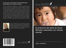 Capa do livro de El síndrome del bebé de llanta Michelin extendido con retraso mental 