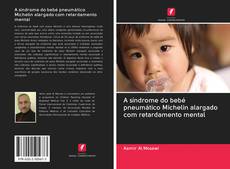 Capa do livro de A síndrome do bebé pneumático Michelin alargado com retardamento mental 