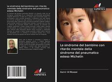 Bookcover of La sindrome del bambino con ritardo mentale della sindrome del pneumatico esteso Michelin
