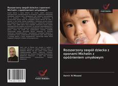 Capa do livro de Rozszerzony zespół dziecka z oponami Michelin z opóźnieniem umysłowym 