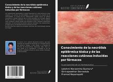 Buchcover von Conocimiento de la necrólisis epidérmica tóxica y de las reacciones cutáneas inducidas por fármacos