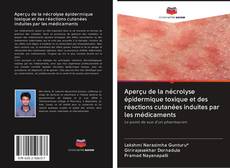 Buchcover von Aperçu de la nécrolyse épidermique toxique et des réactions cutanées induites par les médicaments
