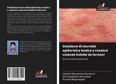 Buchcover von Intuizione di necrolisi epidermica tossica e reazioni cutanee indotte da farmaci