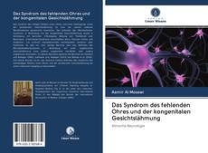 Bookcover of Das Syndrom des fehlenden Ohres und der kongenitalen Gesichtslähmung