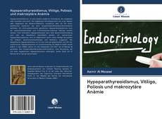 Capa do livro de Hypoparathyreoidismus, Vitiligo, Poliosis und makrozytäre Anämie 