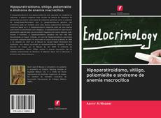 Bookcover of Hipoparatiroidismo, vitiligo, poliomielite e síndrome de anemia macrocítica