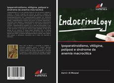 Bookcover of Ipoparatiroidismo, vitiligine, poliposi e sindrome da anemia macrocitica