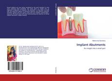 Copertina di Implant Abutments