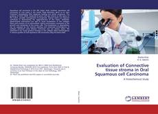 Copertina di Evaluation of Connective tissue stroma in Oral Squamous cell Carcinoma