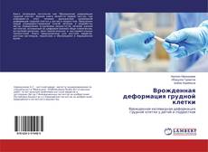 Buchcover von Врожденная деформация грудной клетки