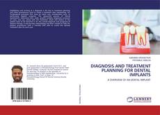 Borítókép a  DIAGNOSIS AND TREATMENT PLANNING FOR DENTAL IMPLANTS - hoz