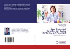 Bookcover of Basic Anatomical Consideration During Dental Implant Placement