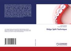 Copertina di Ridge Split Technique