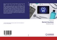 Copertina di Dental Avulsion