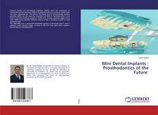 Bookcover of Mini Dental Implants : Prosthodontics of the Future