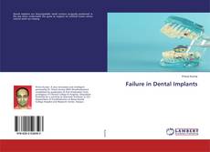 Copertina di Failure in Dental Implants