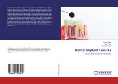 Bookcover of Dental Implant Failures