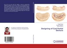 Copertina di Designing of Cast Partial Denture