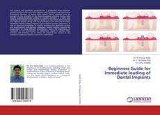 Copertina di Beginners Guide for Immediate loading of Dental Implants