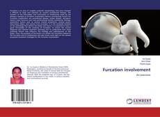 Bookcover of Furcation involvement