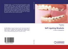 Self Ligating Brackets kitap kapağı