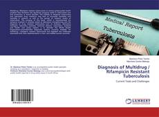Copertina di Diagnosis of Multidrug / Rifampicin Resistant Tuberculosis