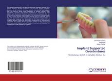 Copertina di Implant Supported Overdentures