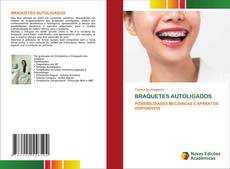 BRAQUETES AUTOLIGADOS kitap kapağı