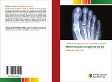 Copertina di Malformação congênita do pé