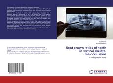 Buchcover von Root crown ratios of teeth in vertical skeletal malocclusions