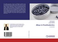 Buchcover von Alloys in Prosthodontics