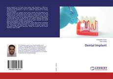 Обложка Dental Implant