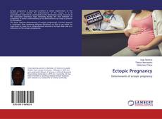 Ectopic Pregnancy的封面