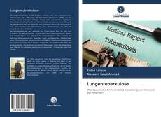 Bookcover of Lungentuberkulose