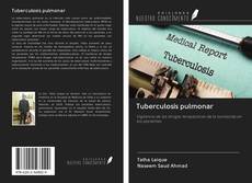 Capa do livro de Tuberculosis pulmonar 