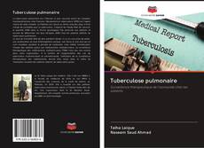 Bookcover of Tuberculose pulmonaire