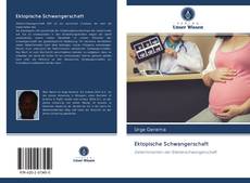 Capa do livro de Ektopische Schwangerschaft 