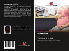 Grossesse ectopique kitap kapağı