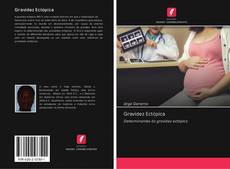 Gravidez Ectópica kitap kapağı