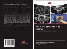 Buchcover von Anomalies congénitales de l'utérus