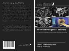 Capa do livro de Anomalías congénitas del útero 