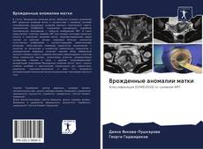 Bookcover of Врожденные аномалии матки