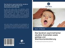 Bookcover of Das Syndrom asymmetrischer okulärer Anomalien sowie geistige und Wachstumsretardierung