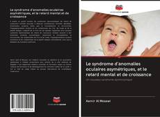 Capa do livro de Le syndrome d'anomalies oculaires asymétriques, et le retard mental et de croissance 