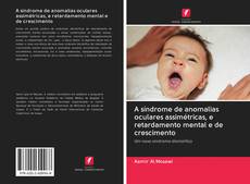 Bookcover of A síndrome de anomalias oculares assimétricas, e retardamento mental e de crescimento