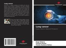 Capa do livro de Lung cancer 