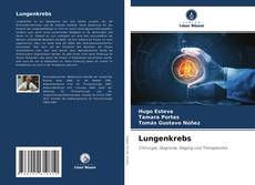 Bookcover of Lungenkrebs